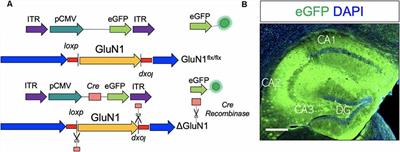 SK Channel Modulates Synaptic Plasticity by Tuning CaMKIIα/β Dynamics